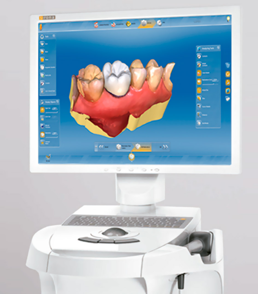 Cerec-01.jpg